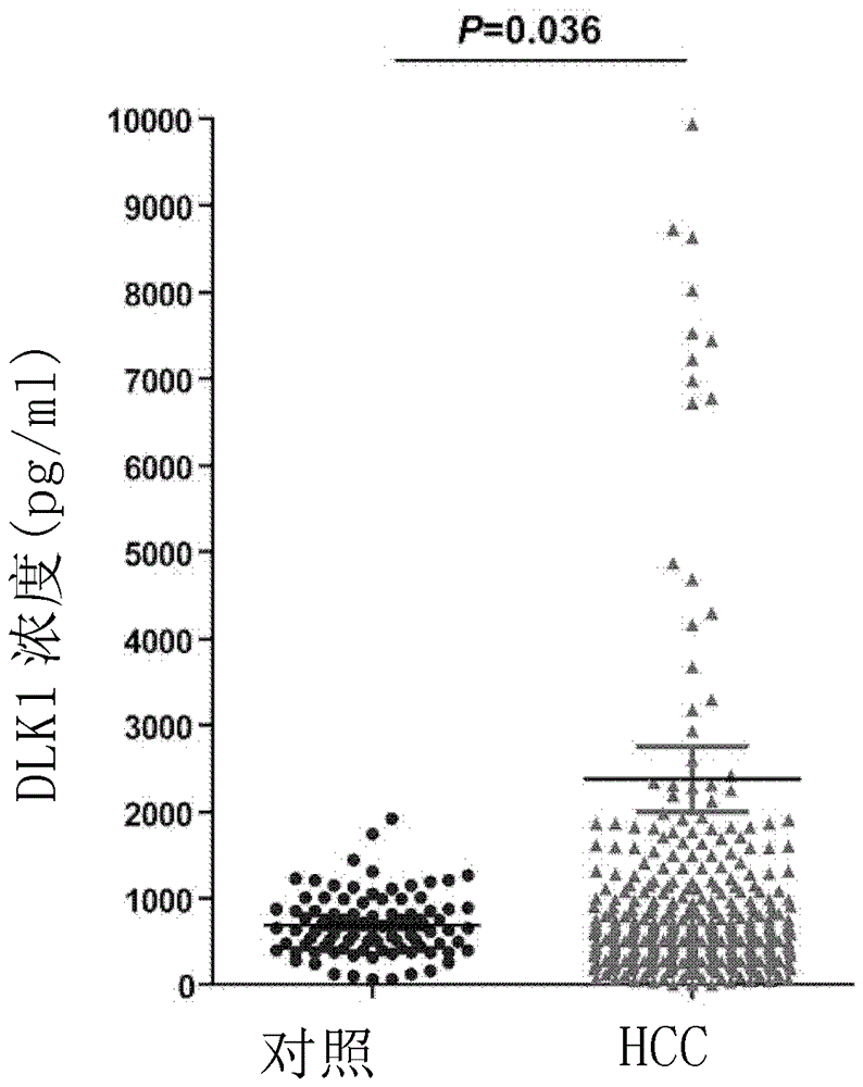 Application of dlk1 in the diagnosis and prognosis of liver cancer