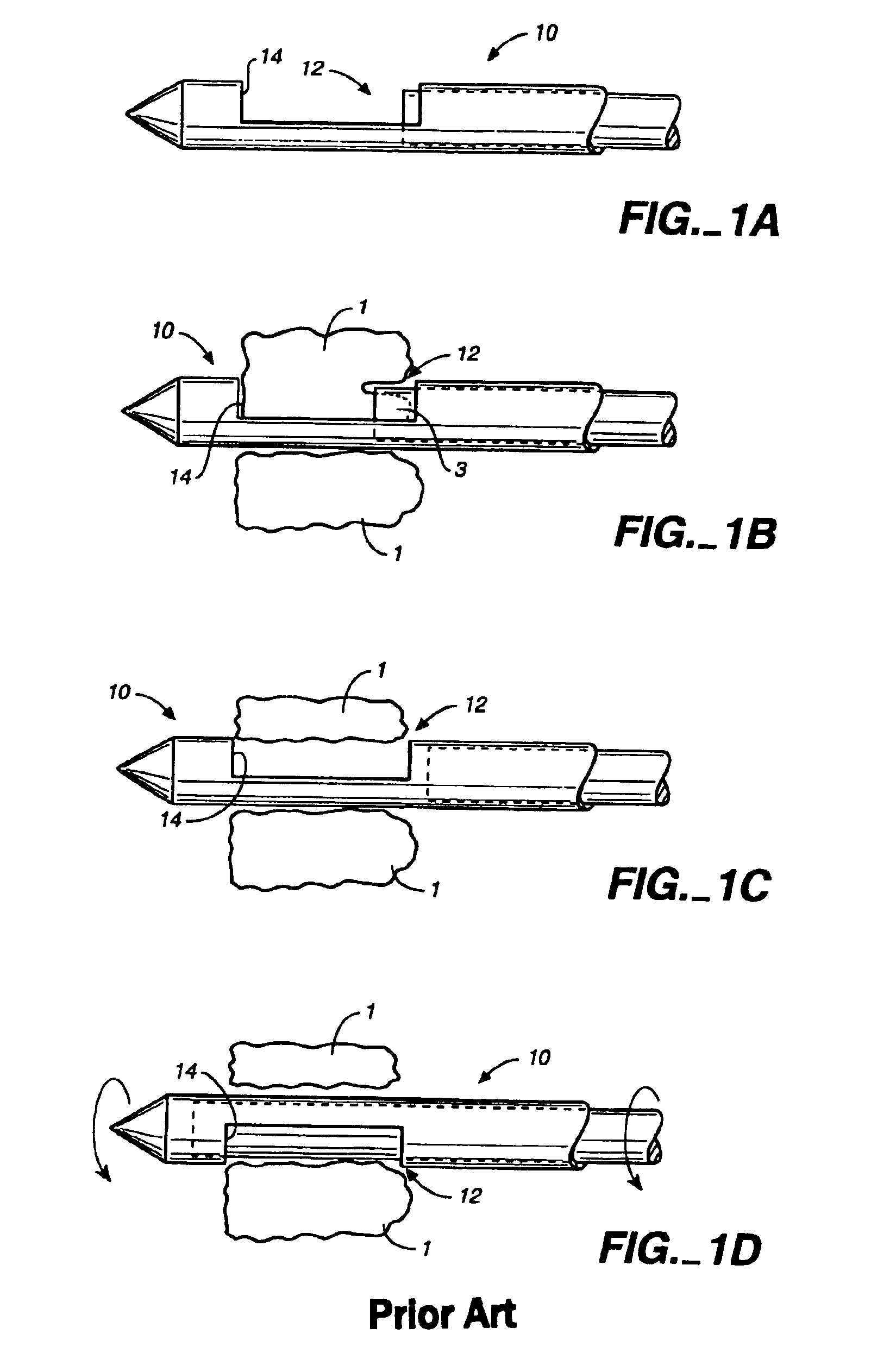 Biopsy marker delivery system