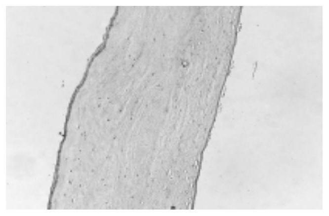 High-performance renewable corneal material, reparation method and application thereof