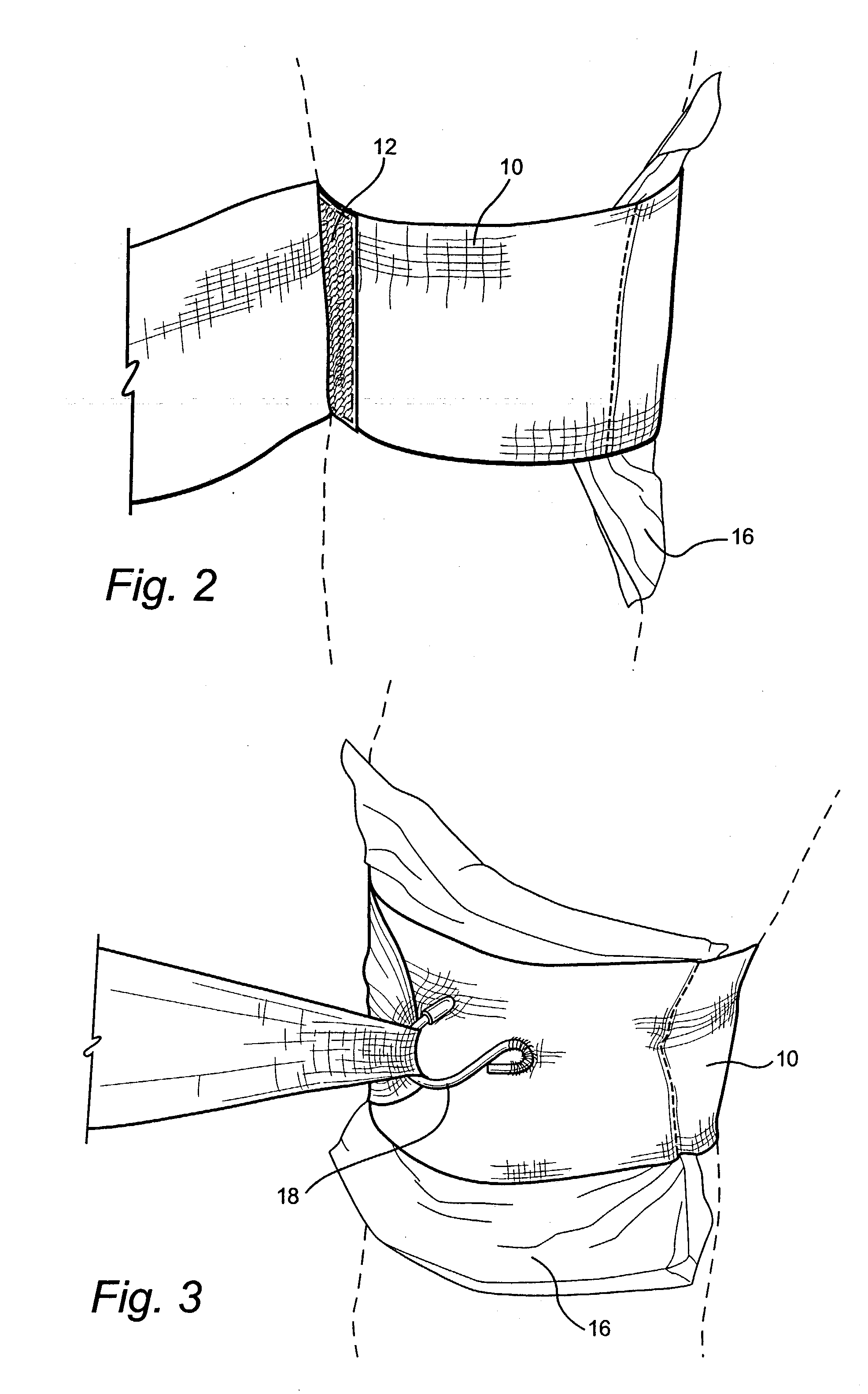 Compression bandage with tightening means