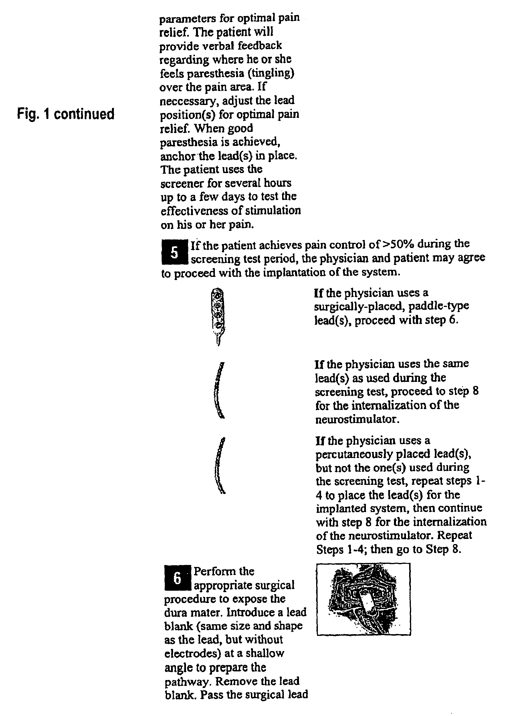 Tunneling needle design having an on-demand removable hub