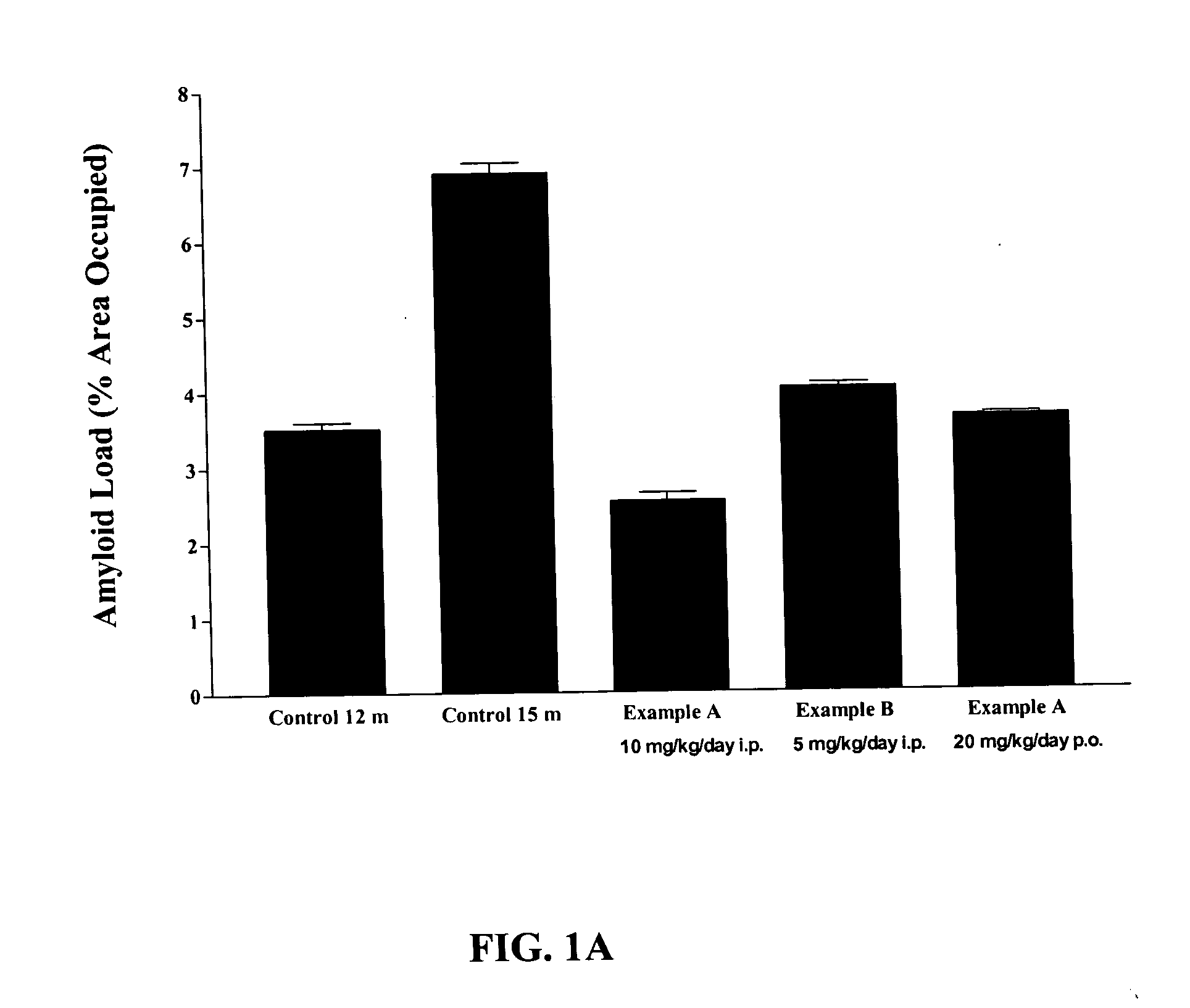 Rage antagonists as agents to reverse amyloidosis and diseases associated therewith