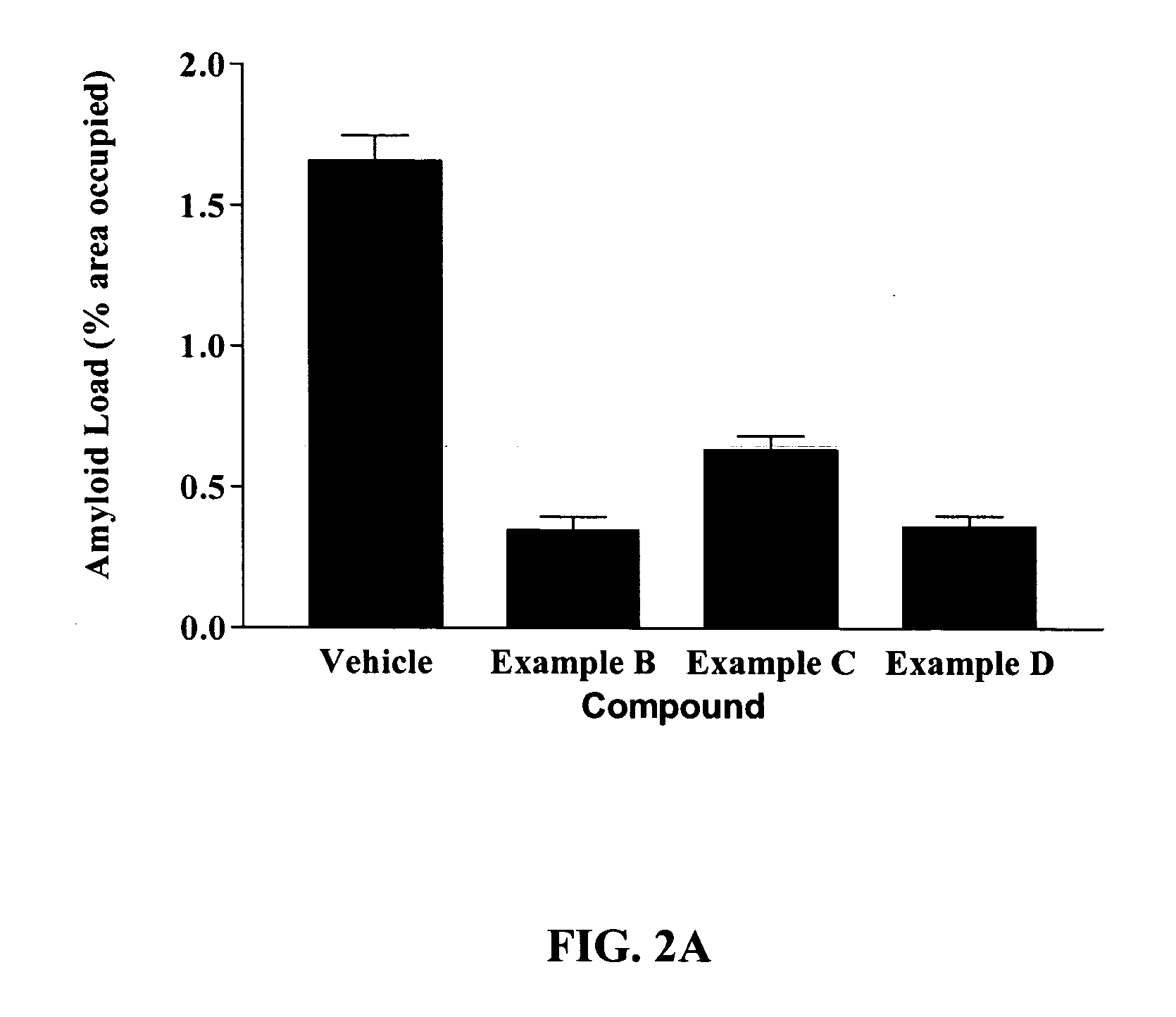 Rage antagonists as agents to reverse amyloidosis and diseases associated therewith