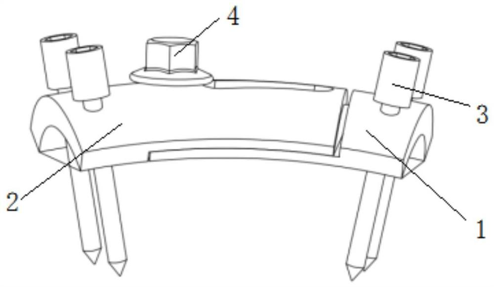 Thoracolumbar spine side adjustable fixing plate system