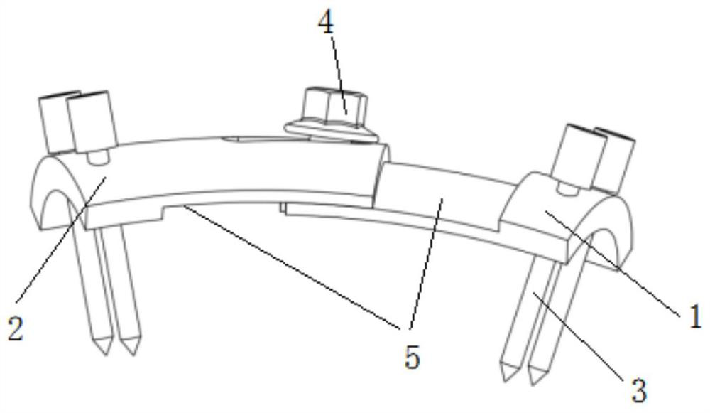 Thoracolumbar spine side adjustable fixing plate system