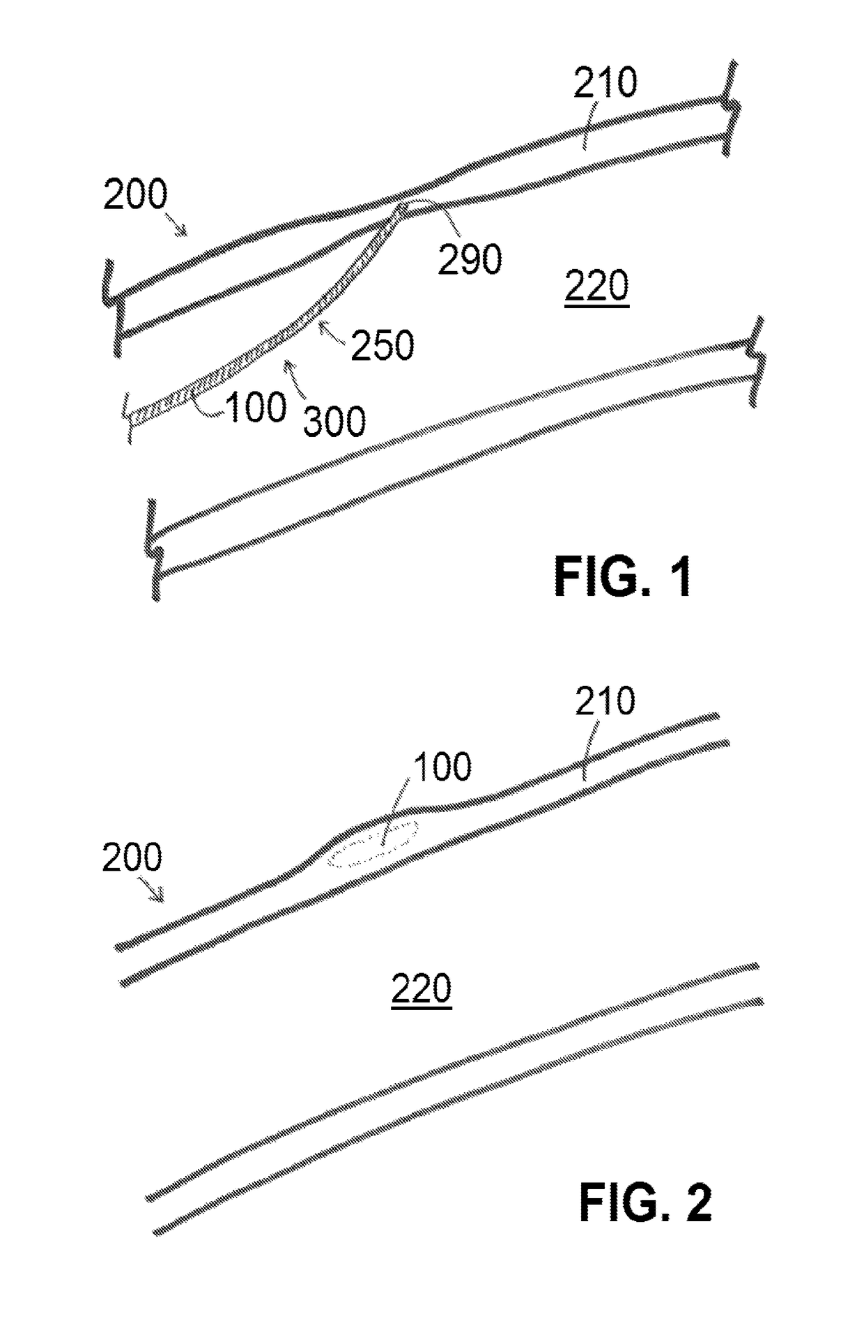 Materials and methods of using the same to improve structural integrity of a wall of a mammalian luminal organ