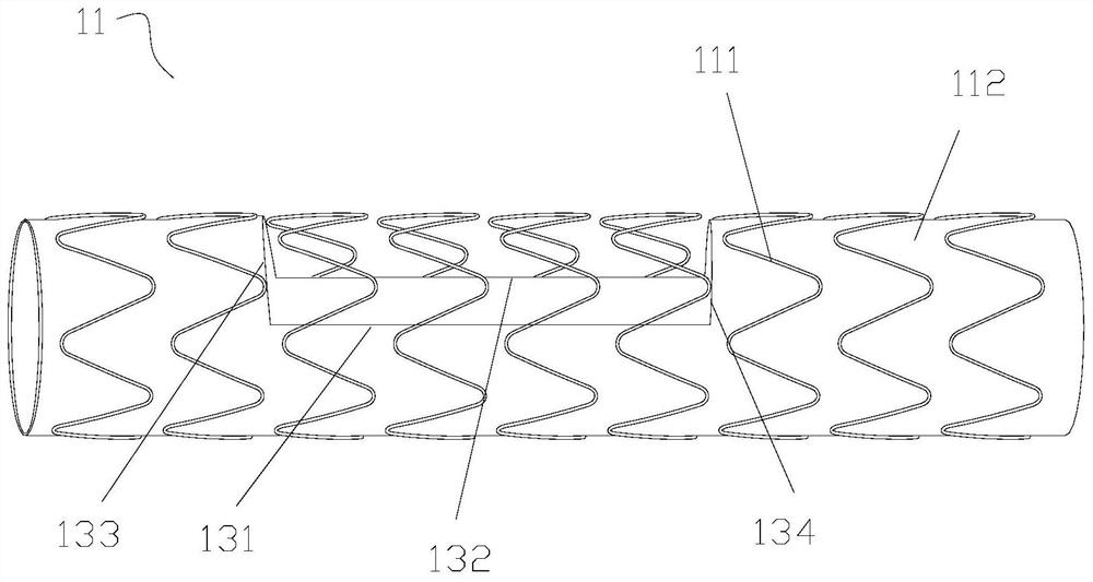 Covered stent