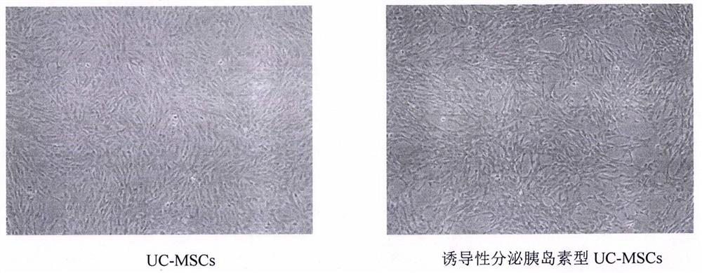 Preparation method and application of stem cells capable of inductively secreting insulin