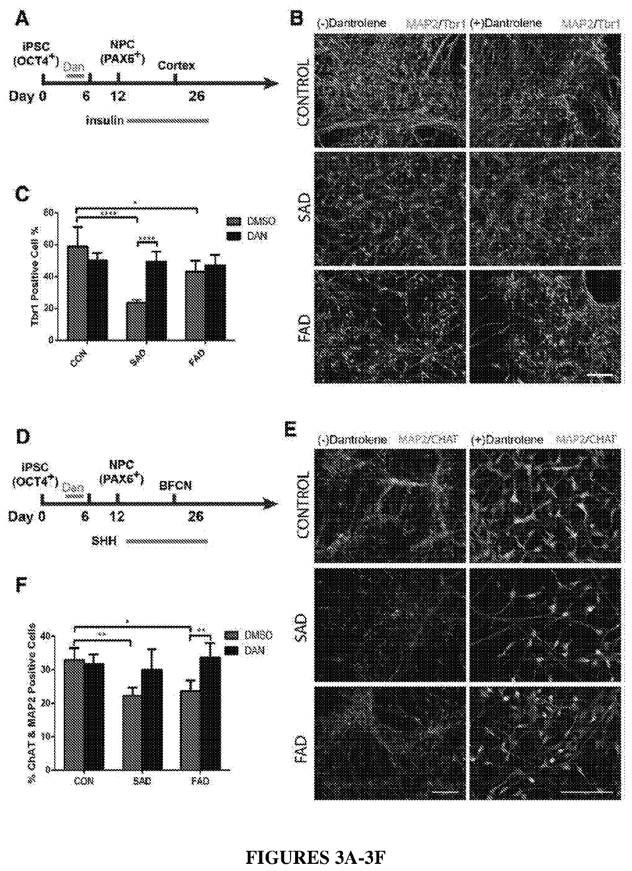 Ntranasal dantrolene administration for treatment of alzheimer's disease