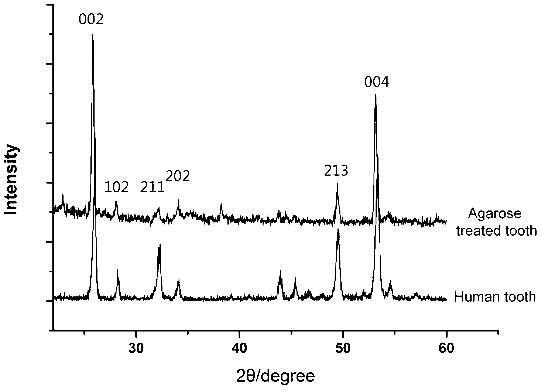 Dental prosthetic material and preparation method thereof