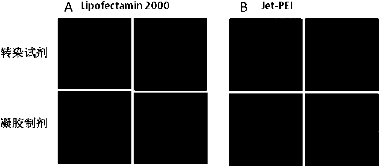 Antiviral small nucleic acid and temperature-sensitive type gel preparation and application thereof