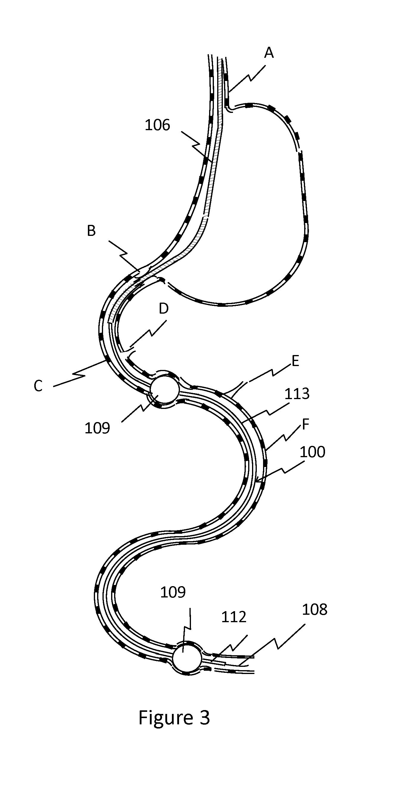 Nutrient Absorption Barrier And Delivery Method