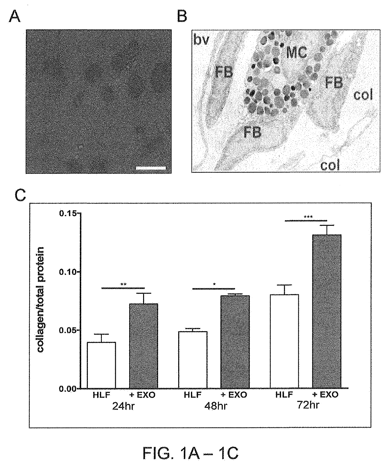 Prevention and treatment of organ fibrosis