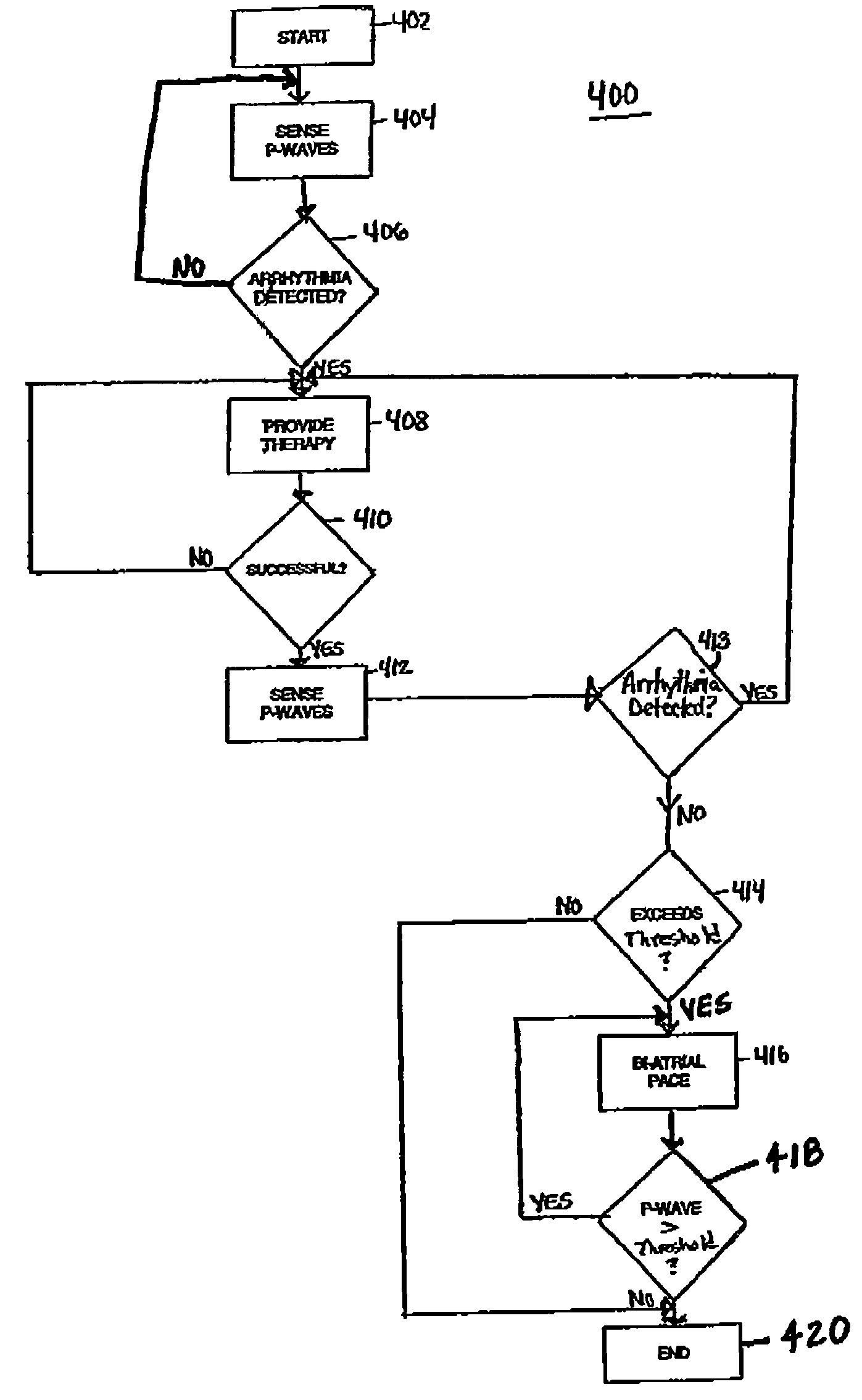 Method and apparatus for affecting atrial defibrillation with bi-atrial pacing