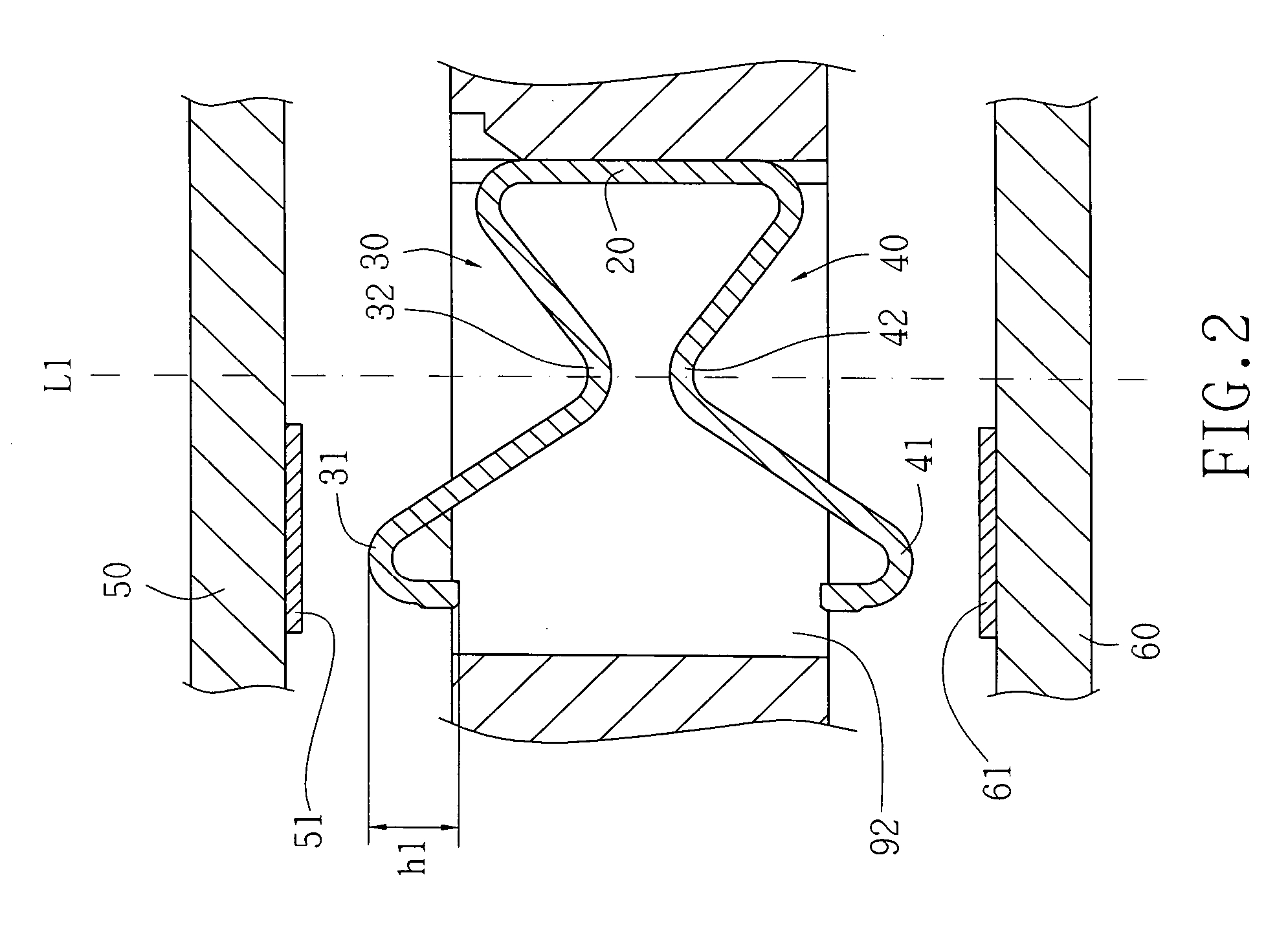 Land grid array terminal having variable circuitry