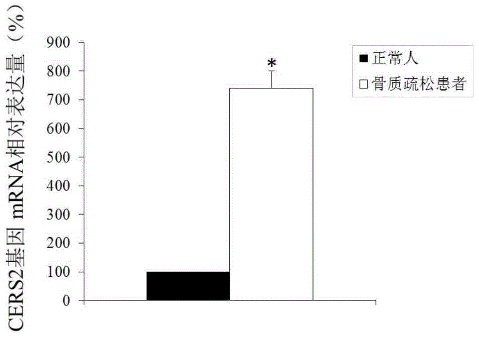 CERS2 (ceramide synthase 2) gene and its expression product serving as treatment target of osteoporosis