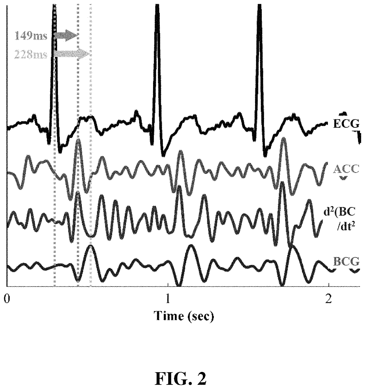 Noninvasive systems and methods for monitoring health characteristics