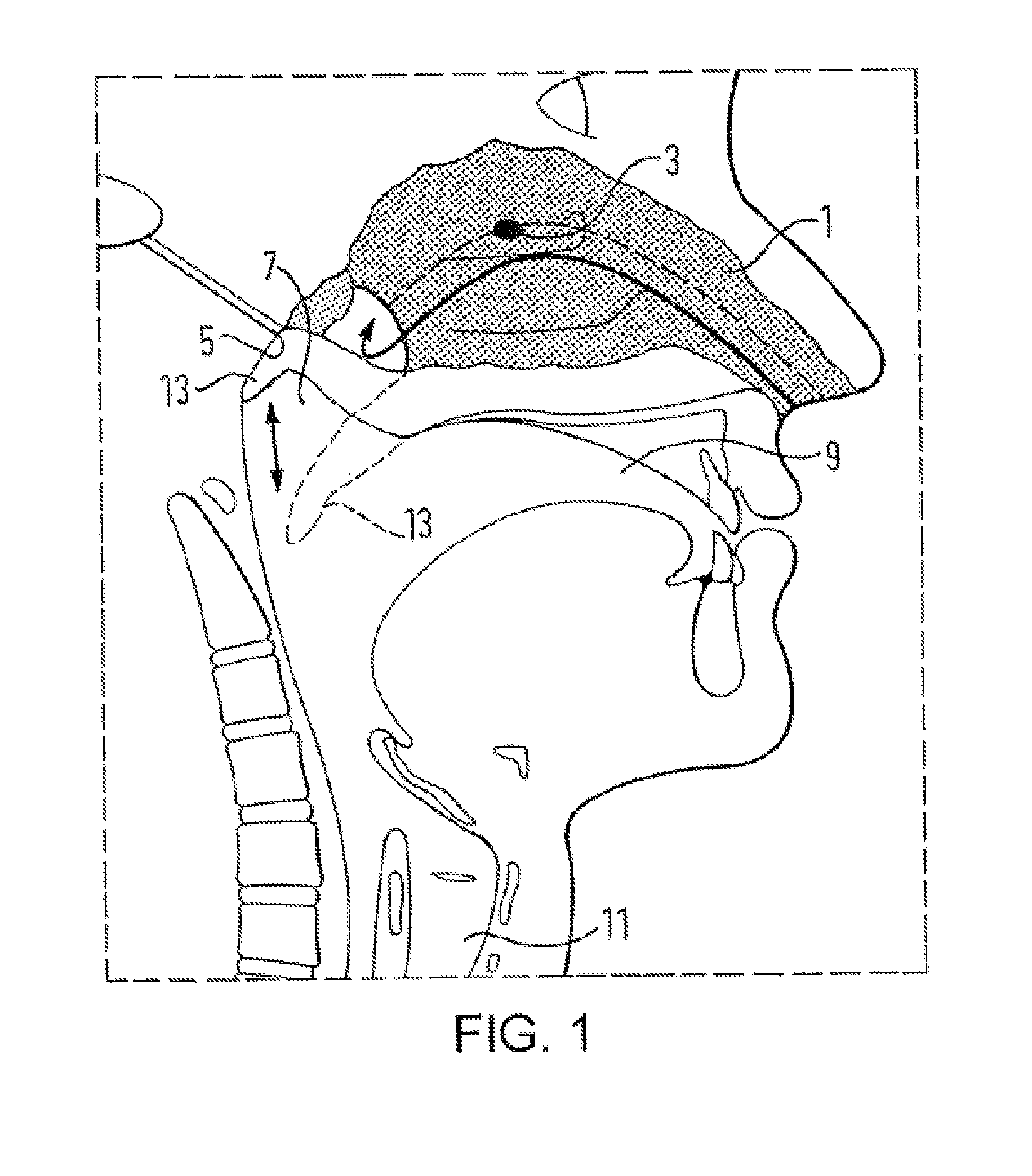 Nasal devices