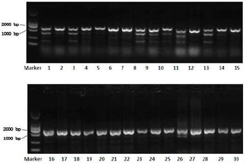 CRISPR/Cas9 targeted knockout of human hepatitis B virus p gene and its specific gRNA