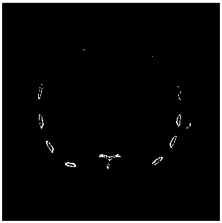 Method and device for extracting pulmonary blood vessels from pectoral CT (computed tomography) images