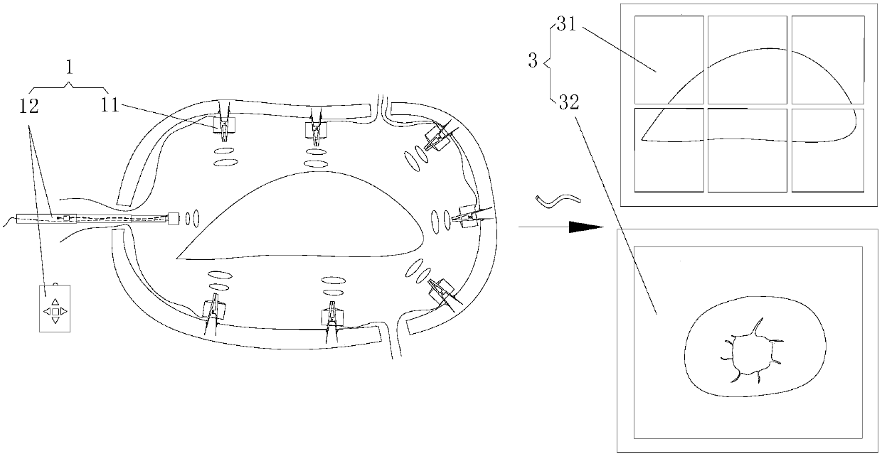 Multi-angle image system for thoracoscope and peritoneoscope