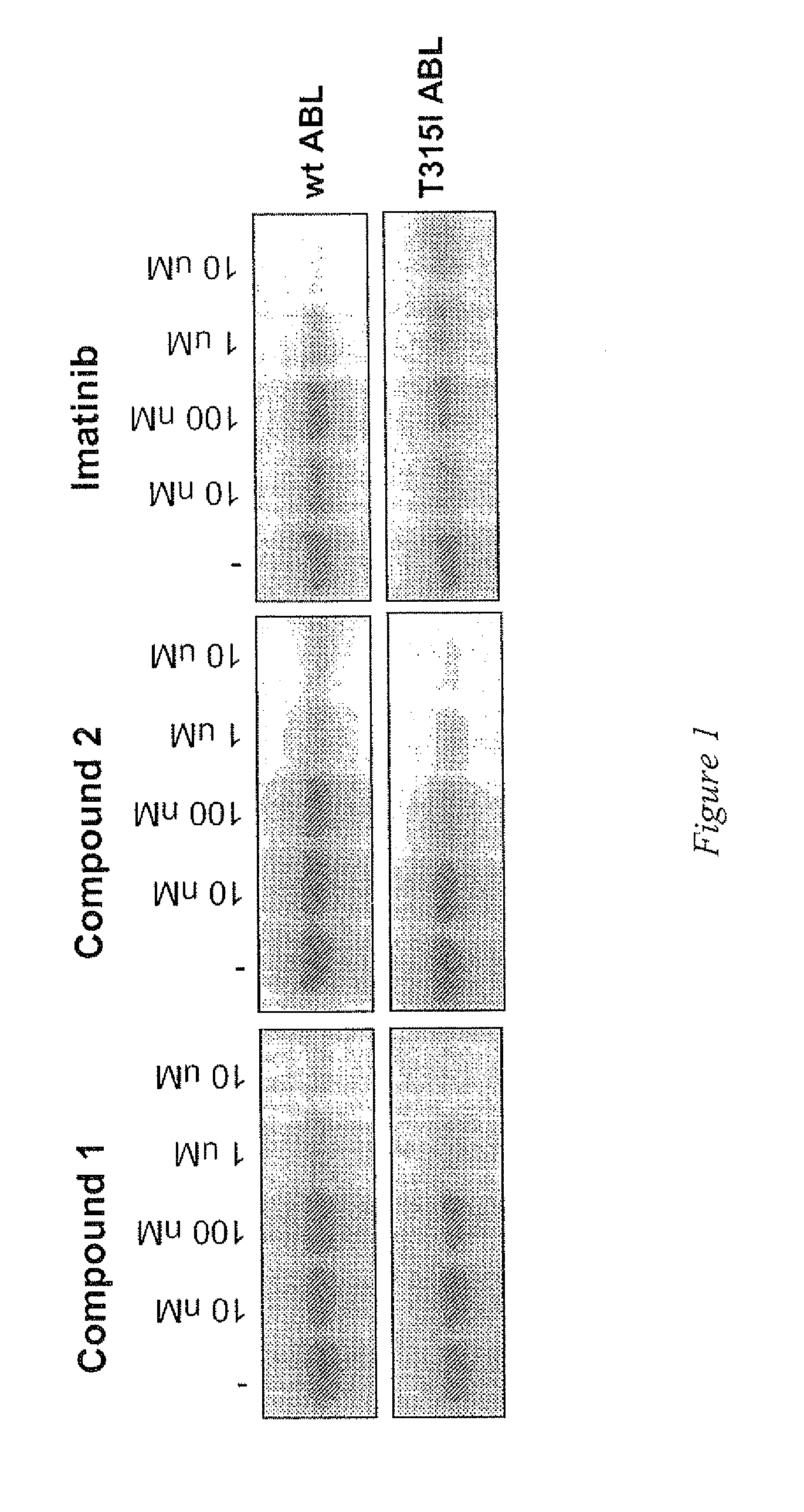 Use of a kinase inhibitor for the treatment of particular resistant tumors