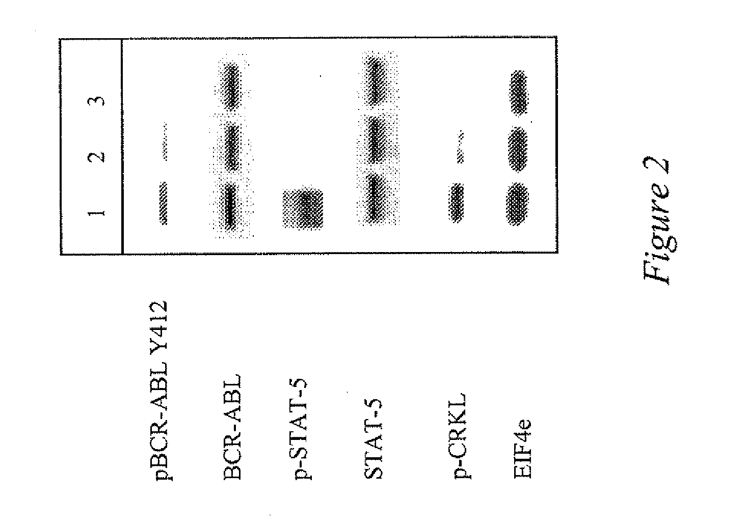 Use of a kinase inhibitor for the treatment of particular resistant tumors