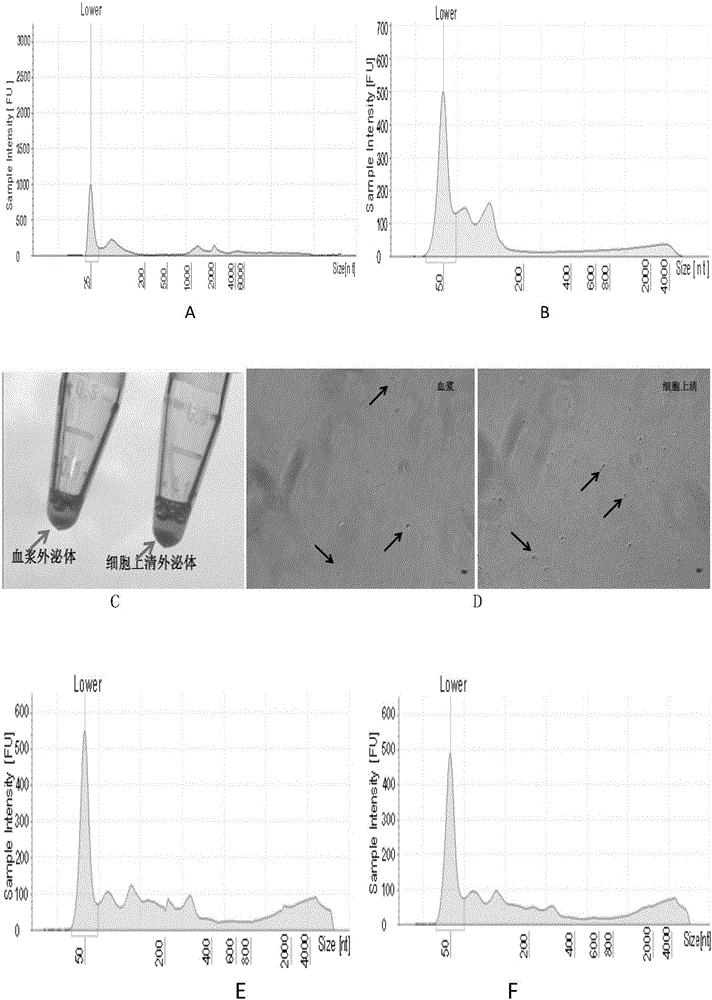 Method and kit for separating exosome