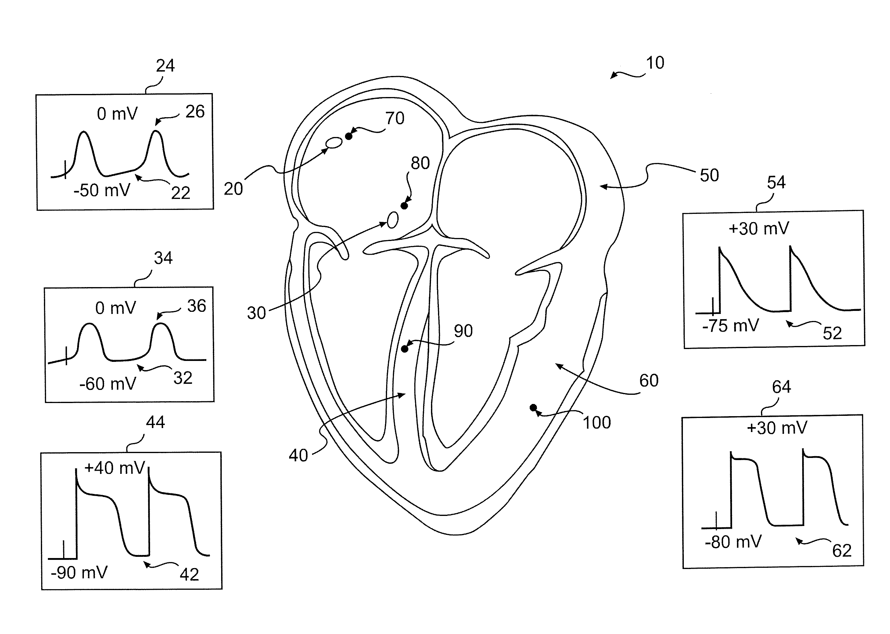 System And Method For Local Field Stimulation