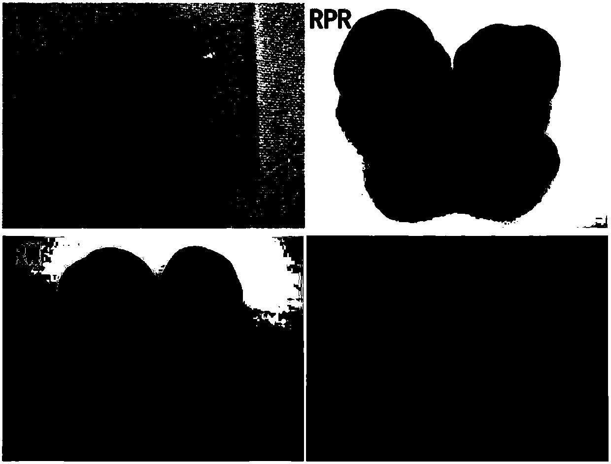 Method for breeding chromatic potato variety with high pigment content