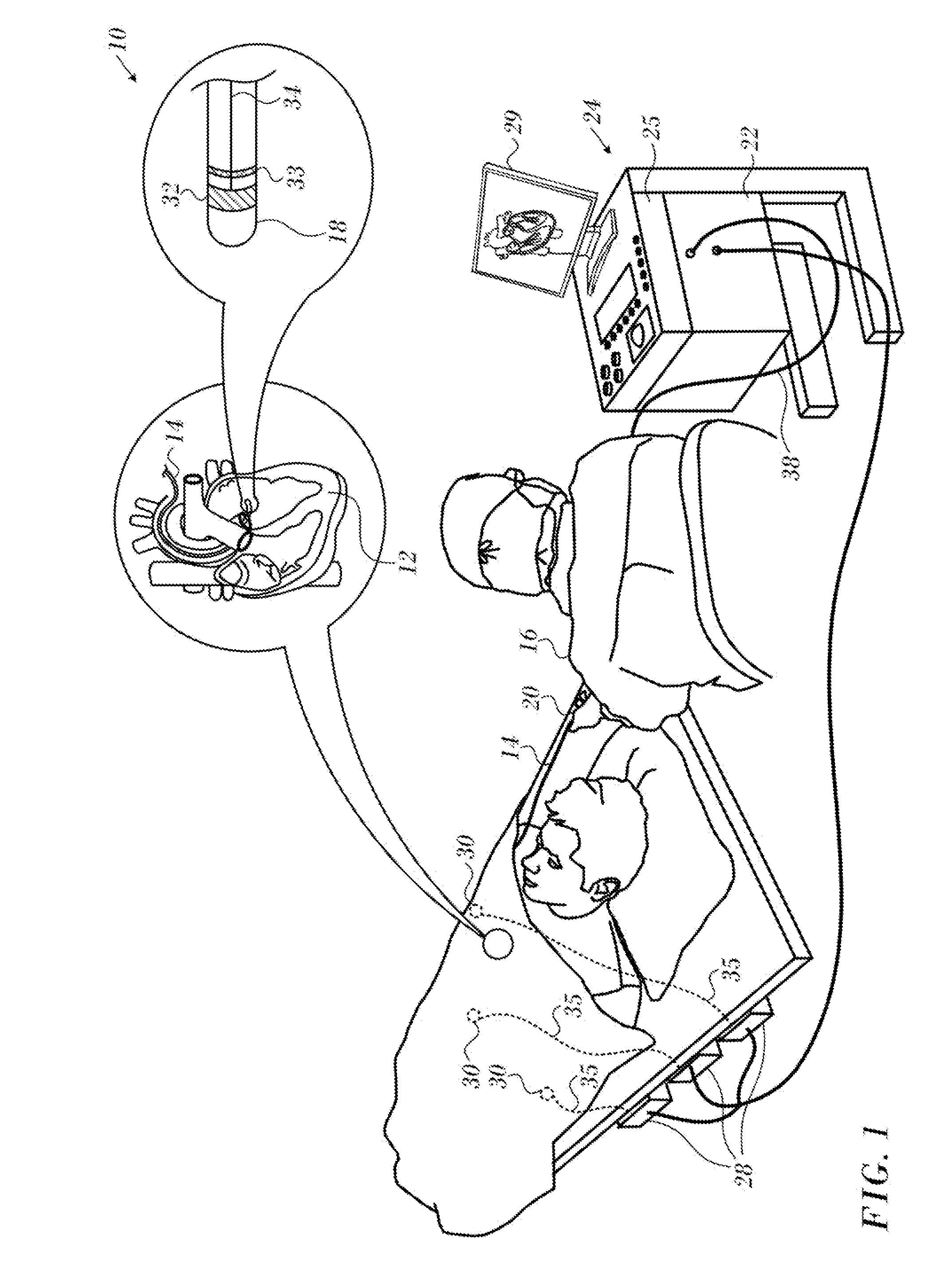 Measurement of tissue thickness using ultrasound and force measurements