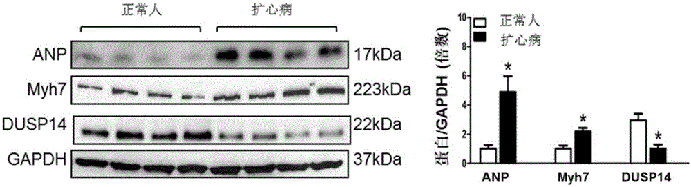 Function and application of dual-specificity phosphatase 14 (DUSP 14) in curing cardiac hypertrophy