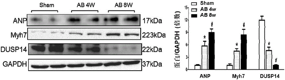 Function and application of dual-specificity phosphatase 14 (DUSP 14) in curing cardiac hypertrophy