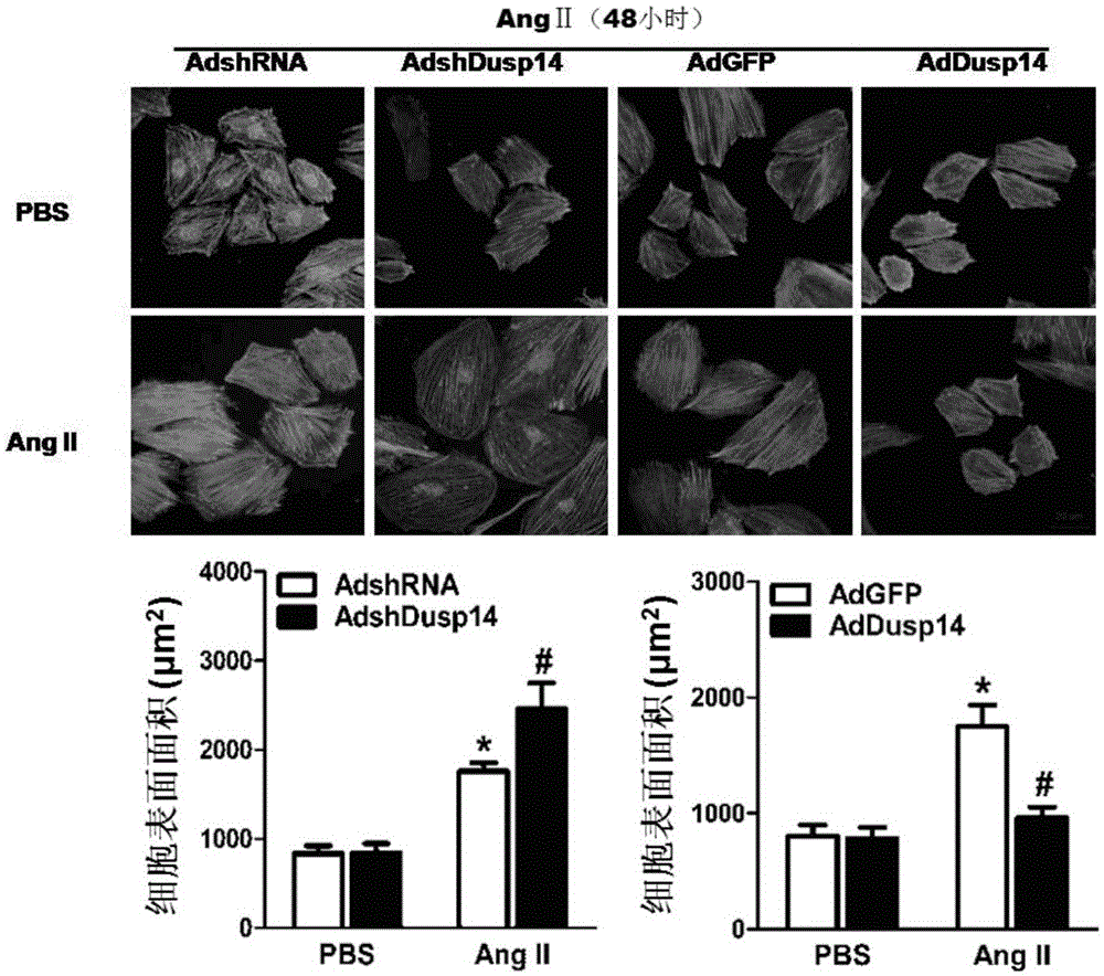 Function and application of dual-specificity phosphatase 14 (DUSP 14) in curing cardiac hypertrophy