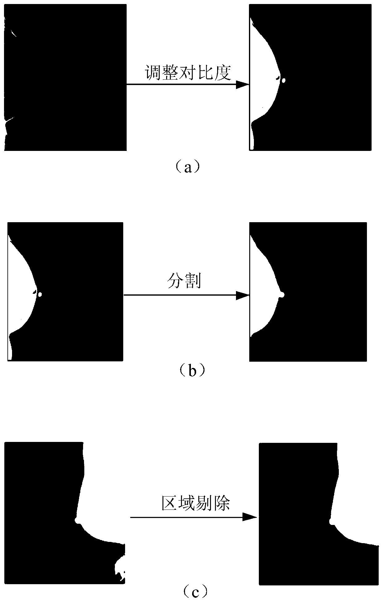 Mammary gland molybdenum target image segmentation method and device, terminal and storage medium