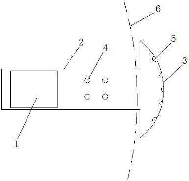 transscleral drug delivery system