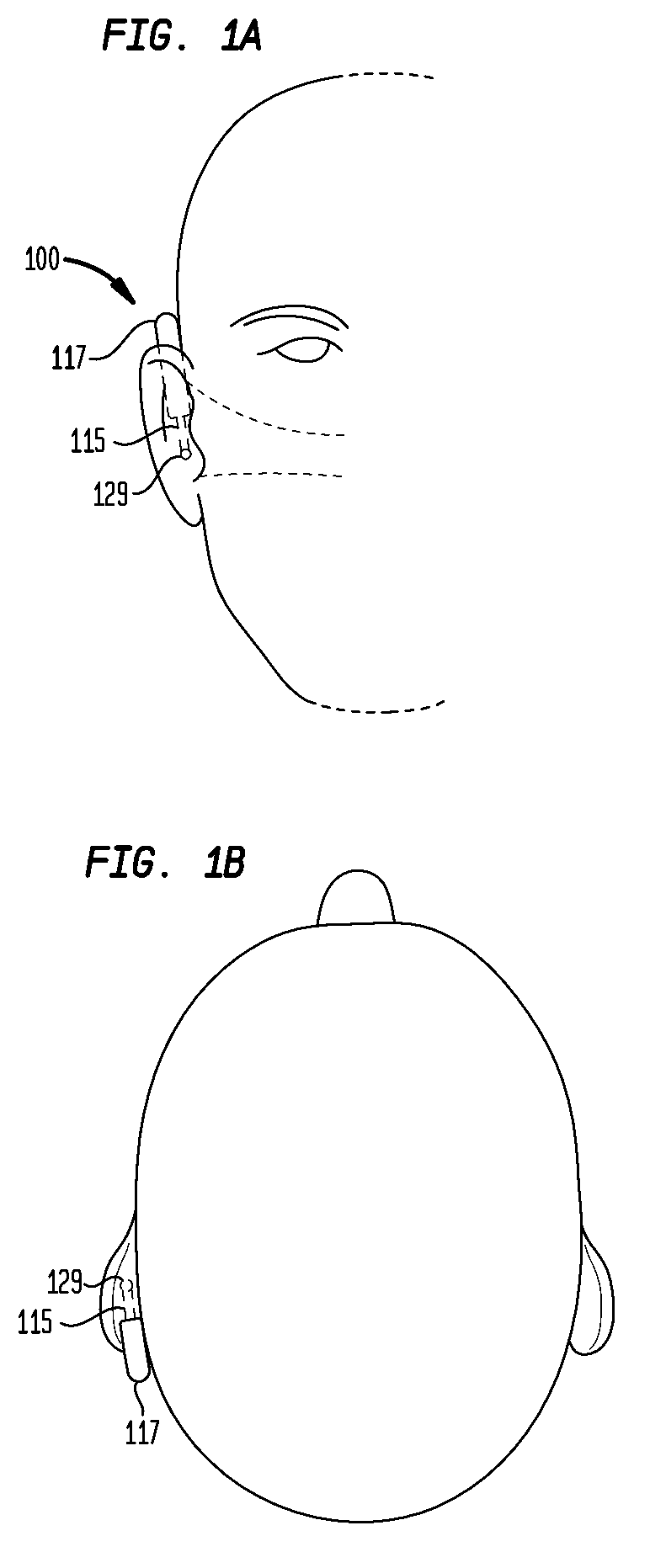 Piercing conducted bone conduction device