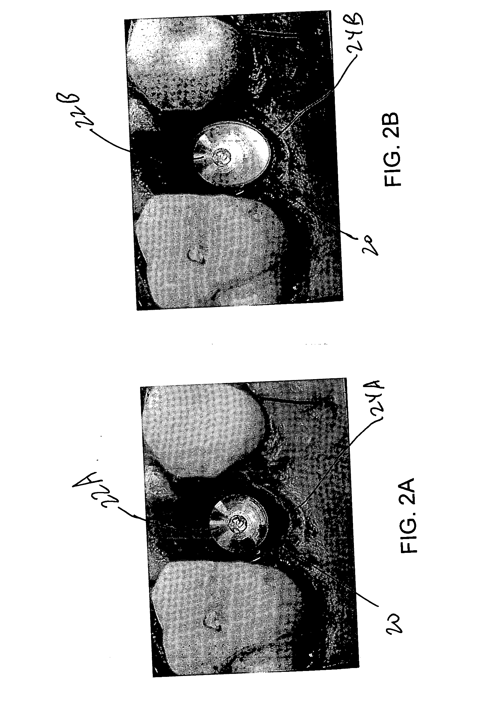 Dental implants having anatomical emergence