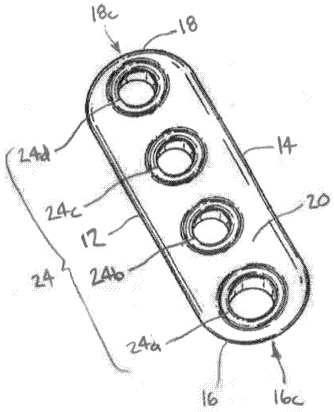 Implant having filament limbs of an adjustable loop disposed in a shuttle suture