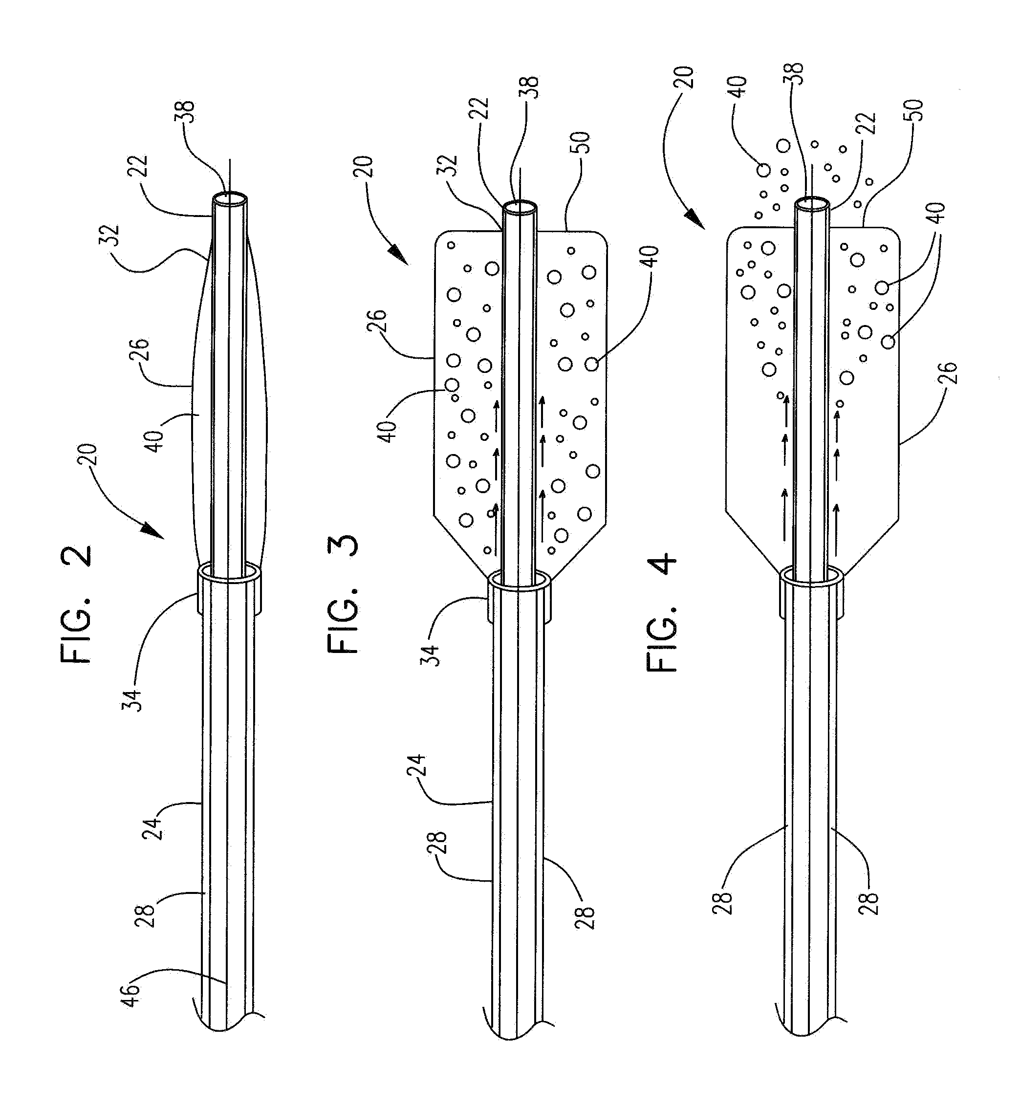 Methods, devices and compositions for controlled drug delivery to injured myocardium