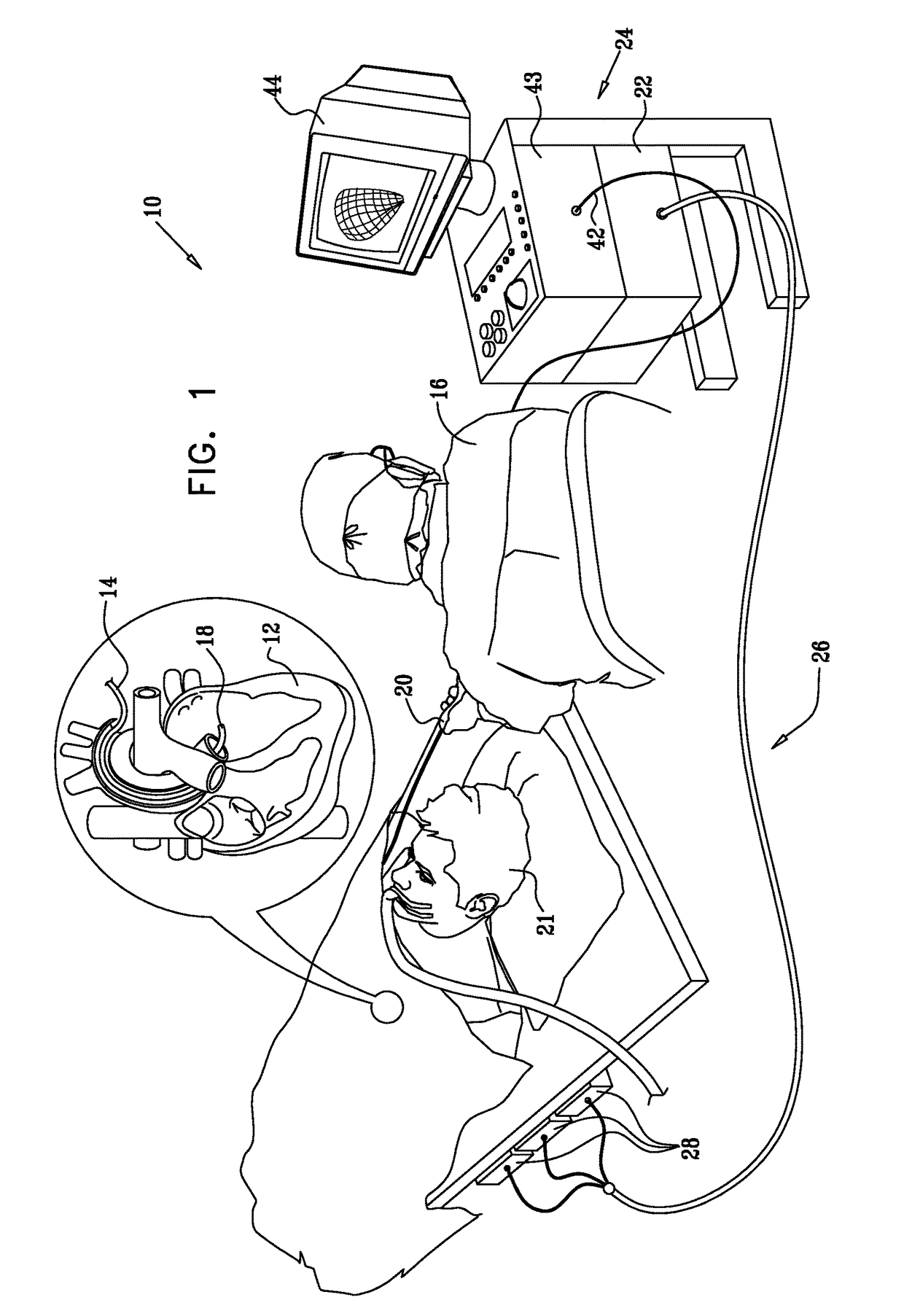 Mapping of complex fractionated atrial electrogram