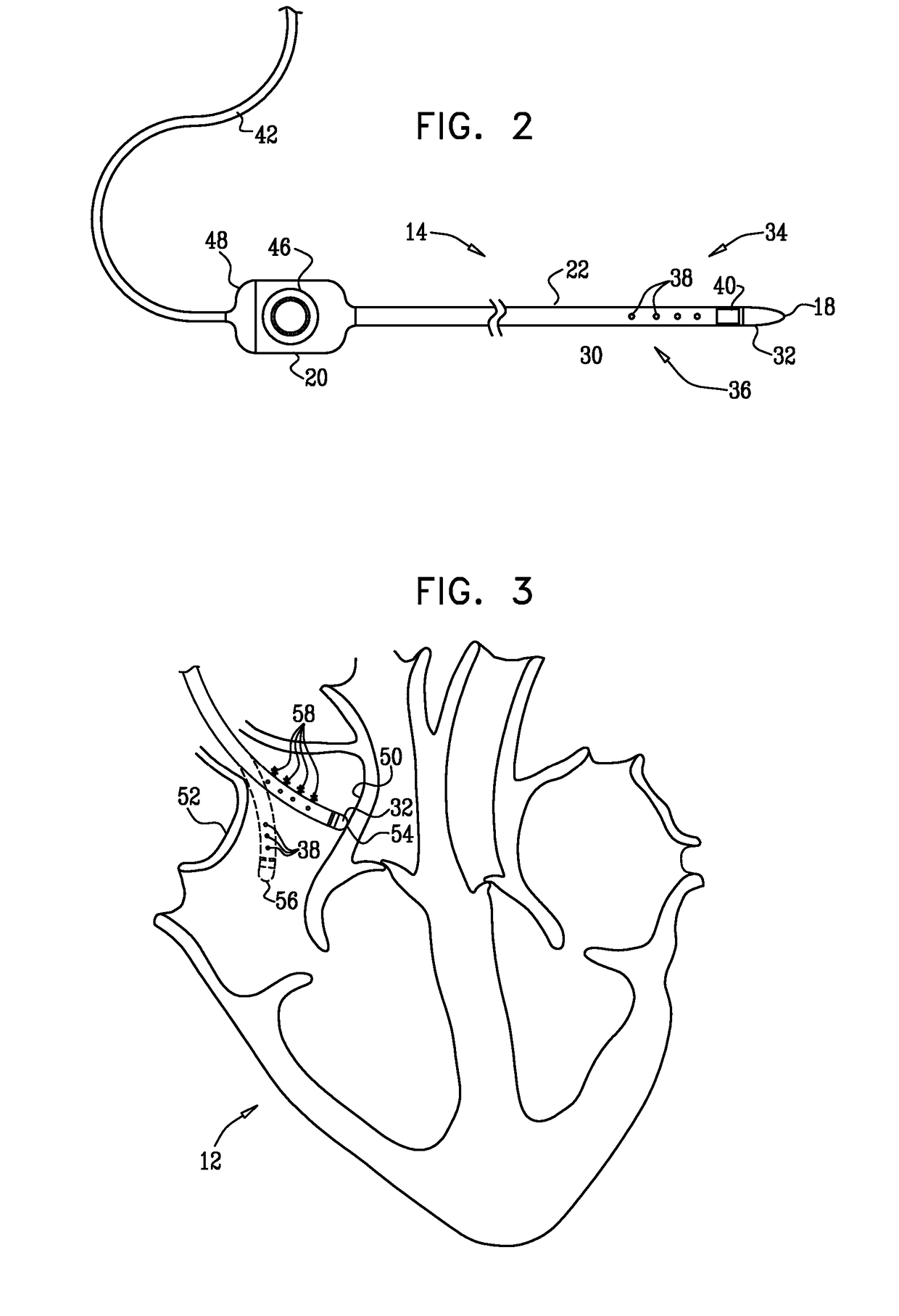 Mapping of complex fractionated atrial electrogram