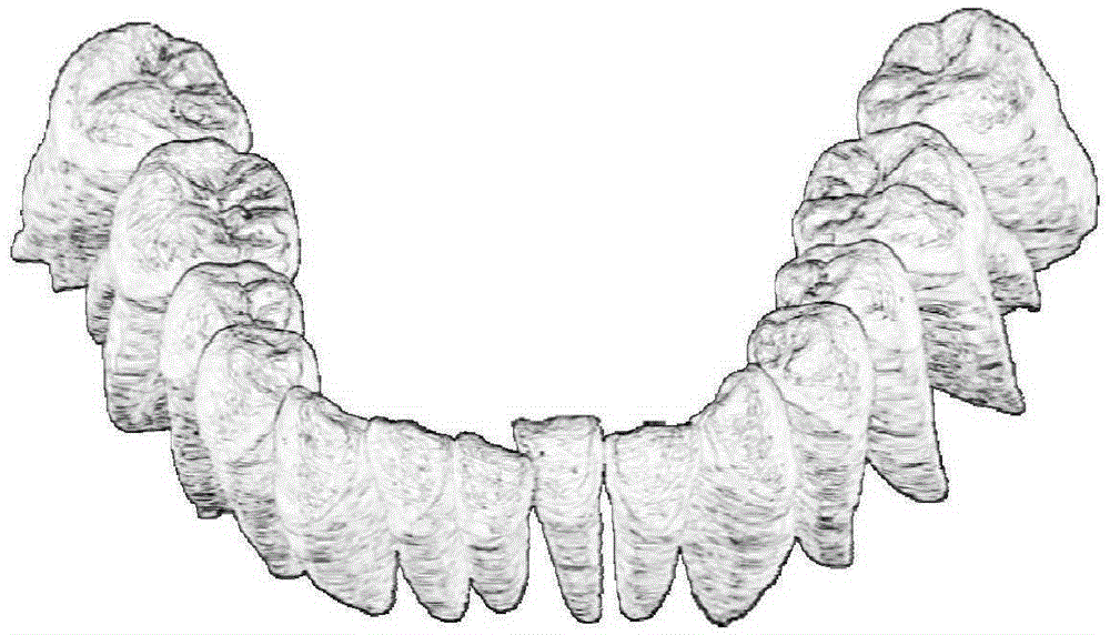 Crown root three-dimensional model merging method