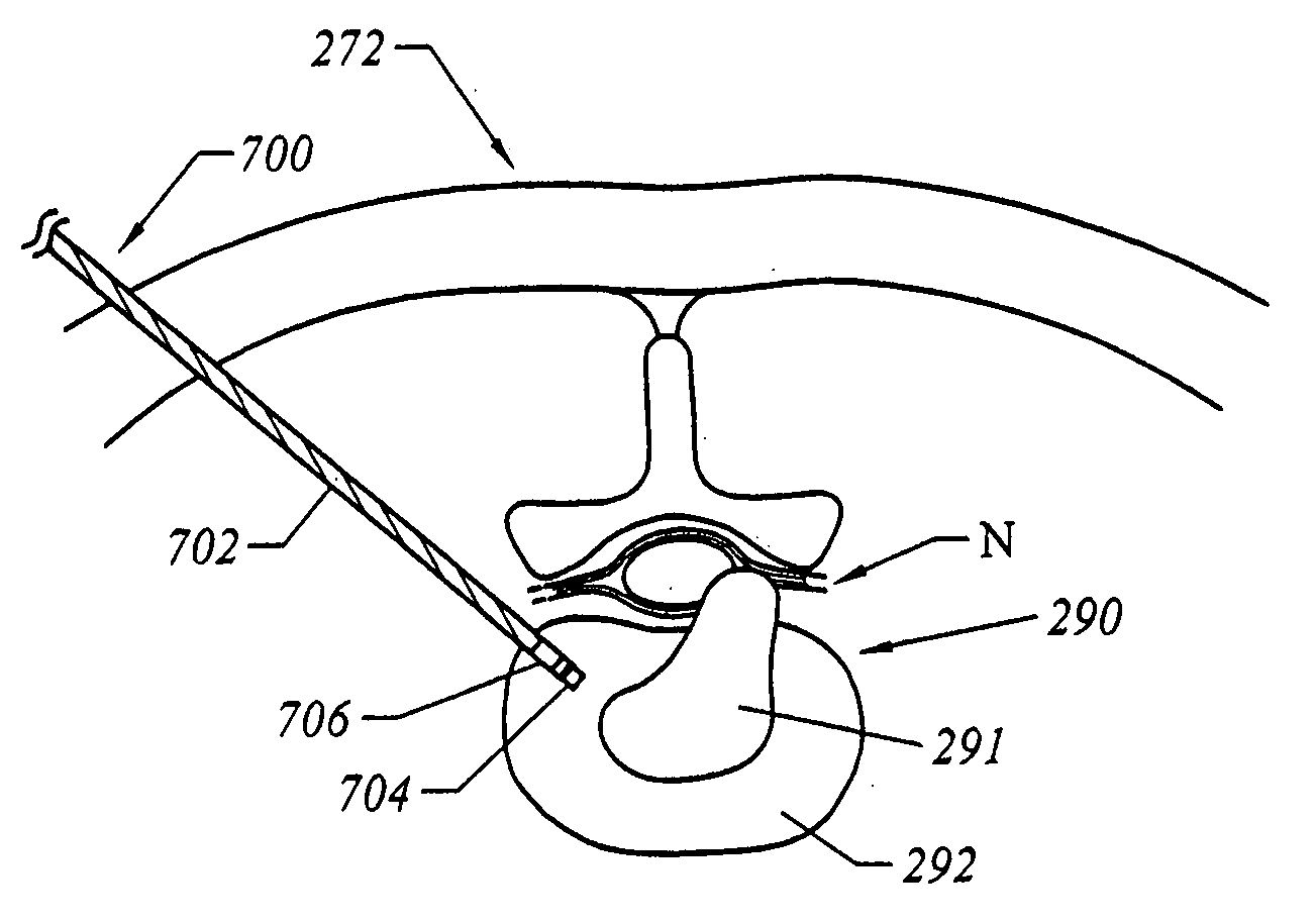 Methods for electrosurgical treatment of spinal tissue