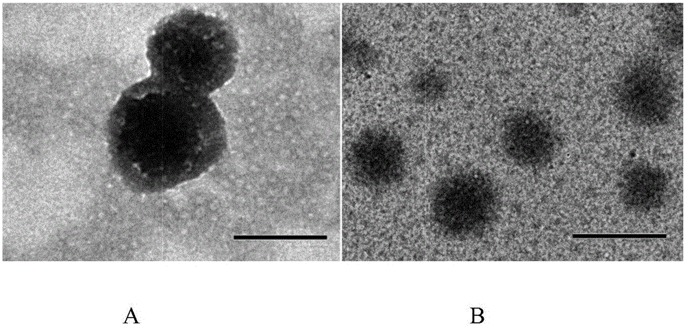 Cerebral arterial thrombosis targeted red cell membrane bionic intellectual drug carrier and preparation method thereof