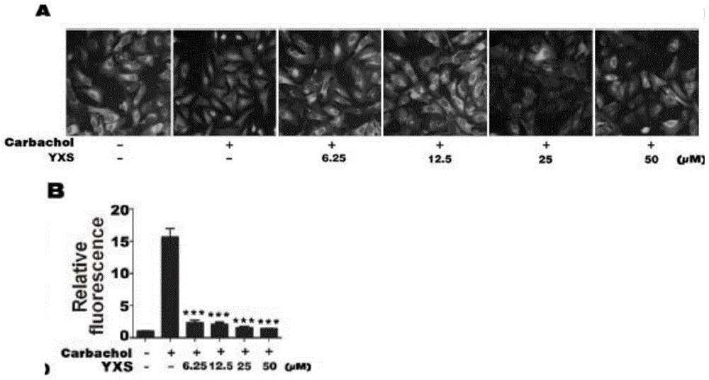 Application of ginkgolic acid in preparation of medicine for preventing and/or treating diseases caused by overactivity of osteoclast