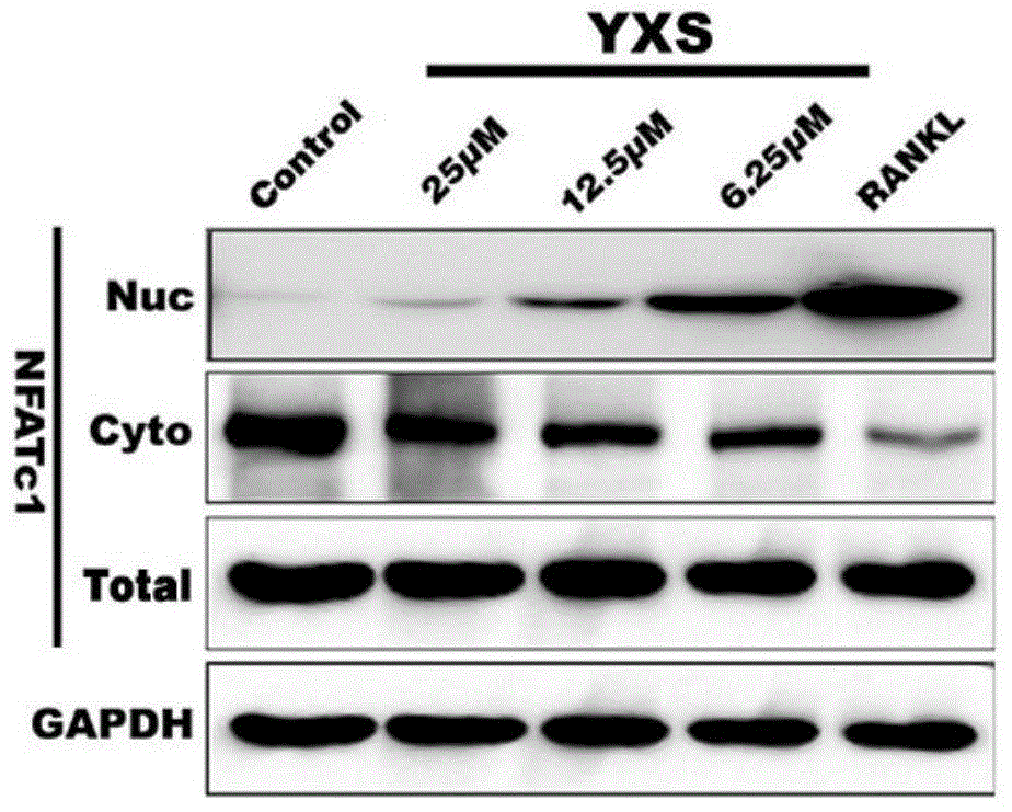 Application of ginkgolic acid in preparation of medicine for preventing and/or treating diseases caused by overactivity of osteoclast