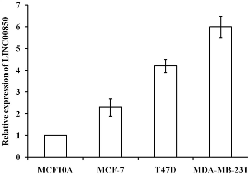 Gene, expression vector and application for inhibiting proliferation, invasion and metastasis of breast cancer cells