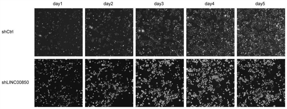 Gene, expression vector and application for inhibiting proliferation, invasion and metastasis of breast cancer cells