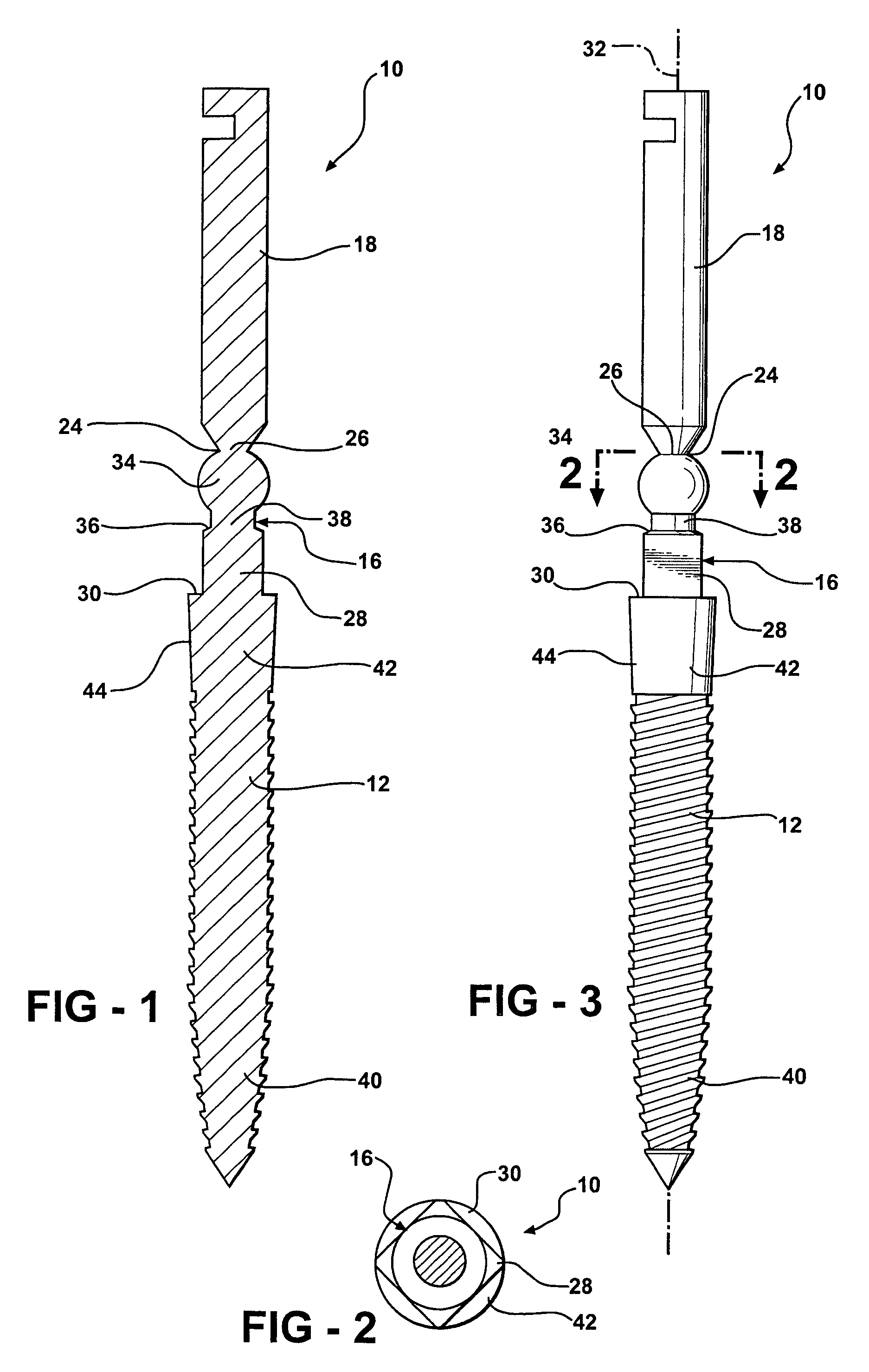 Prosthetic mounting device